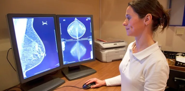 Mamografía: clave para detectar cáncer de mama a tiempo en República Dominicana