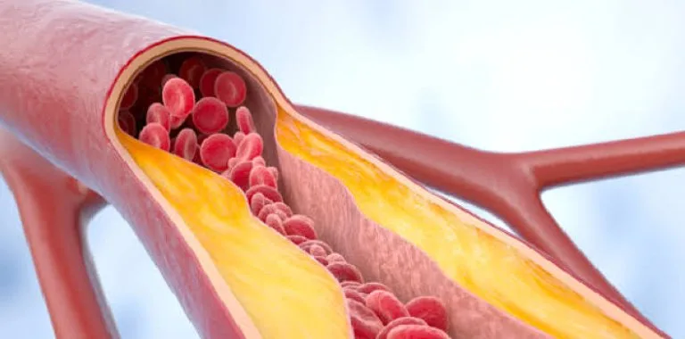 Cómo aumentar el colesterol HDL de forma saludable: evidencia y recomendaciones