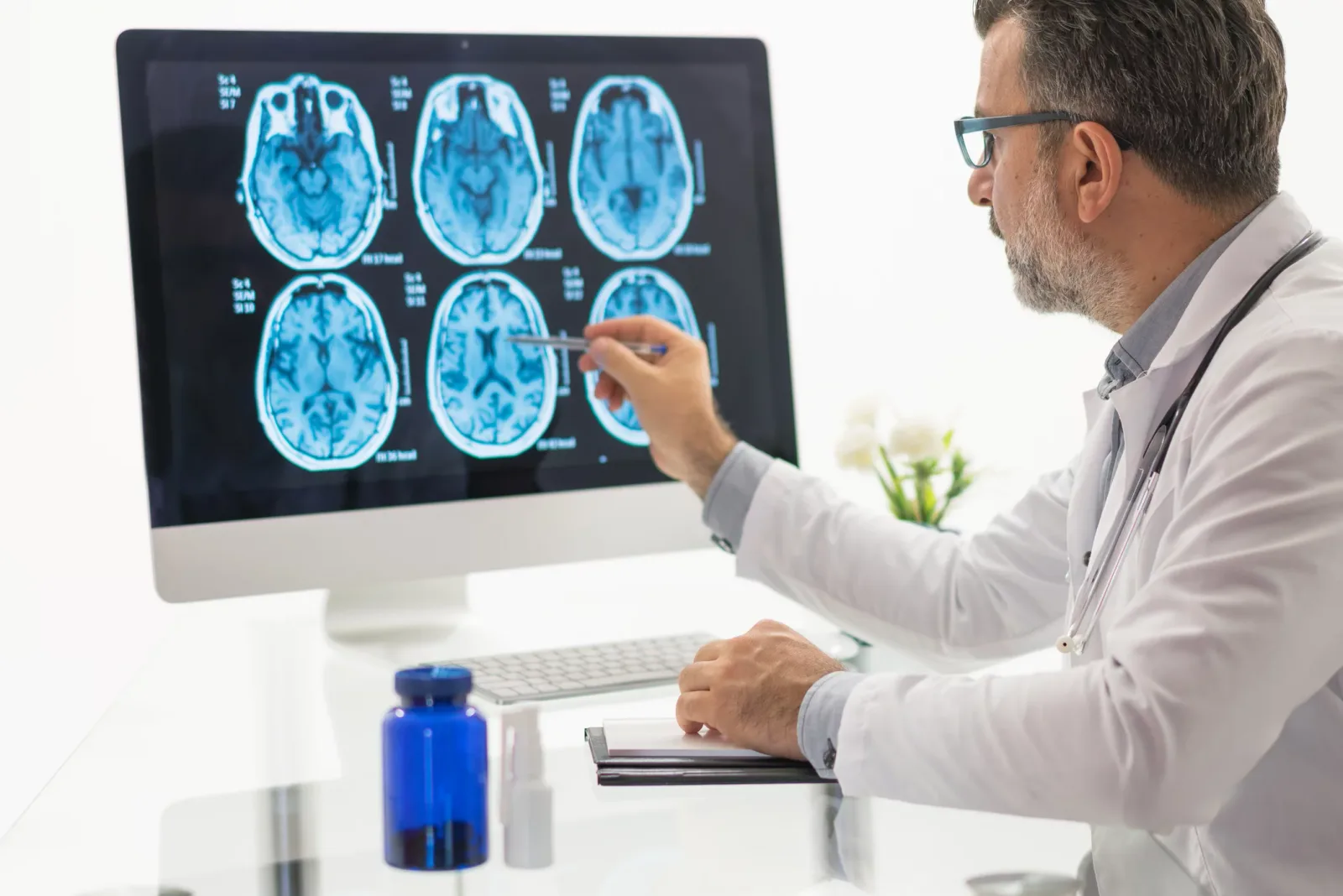 Estudio revela que los cambios cerebrales del Alzheimer inician en los finales de los 50