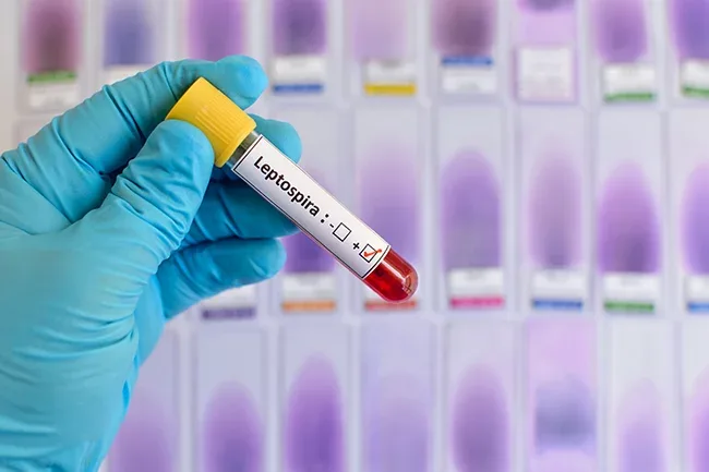 Leptospirosis en RD: 19 muertes y aumento del 172% en casos hasta agosto