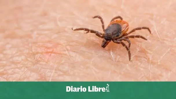 CDC alerta sobre fiebre manchada de las Montañas Rocosas en viajeros desde México
